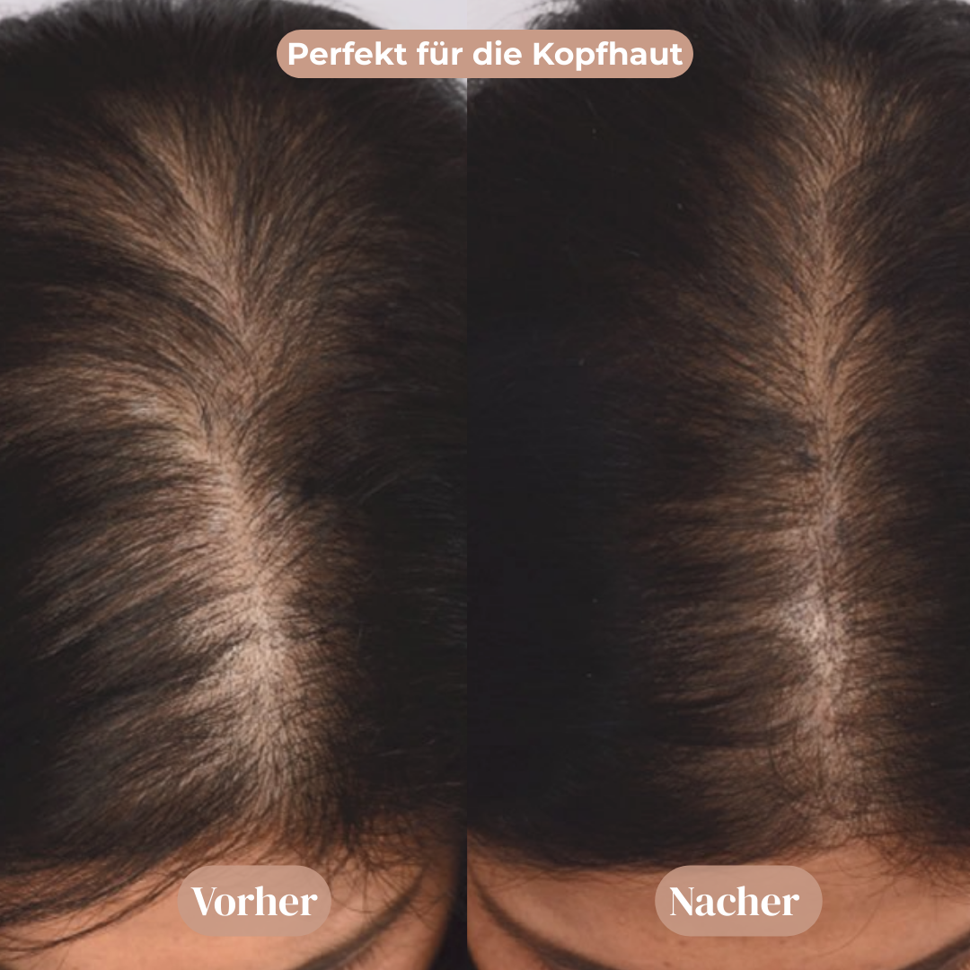 Rosmarin Haarpflegeöl™