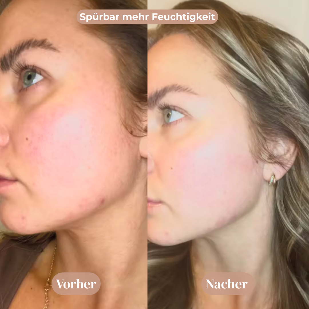 Vitamin Gesichtscreme™