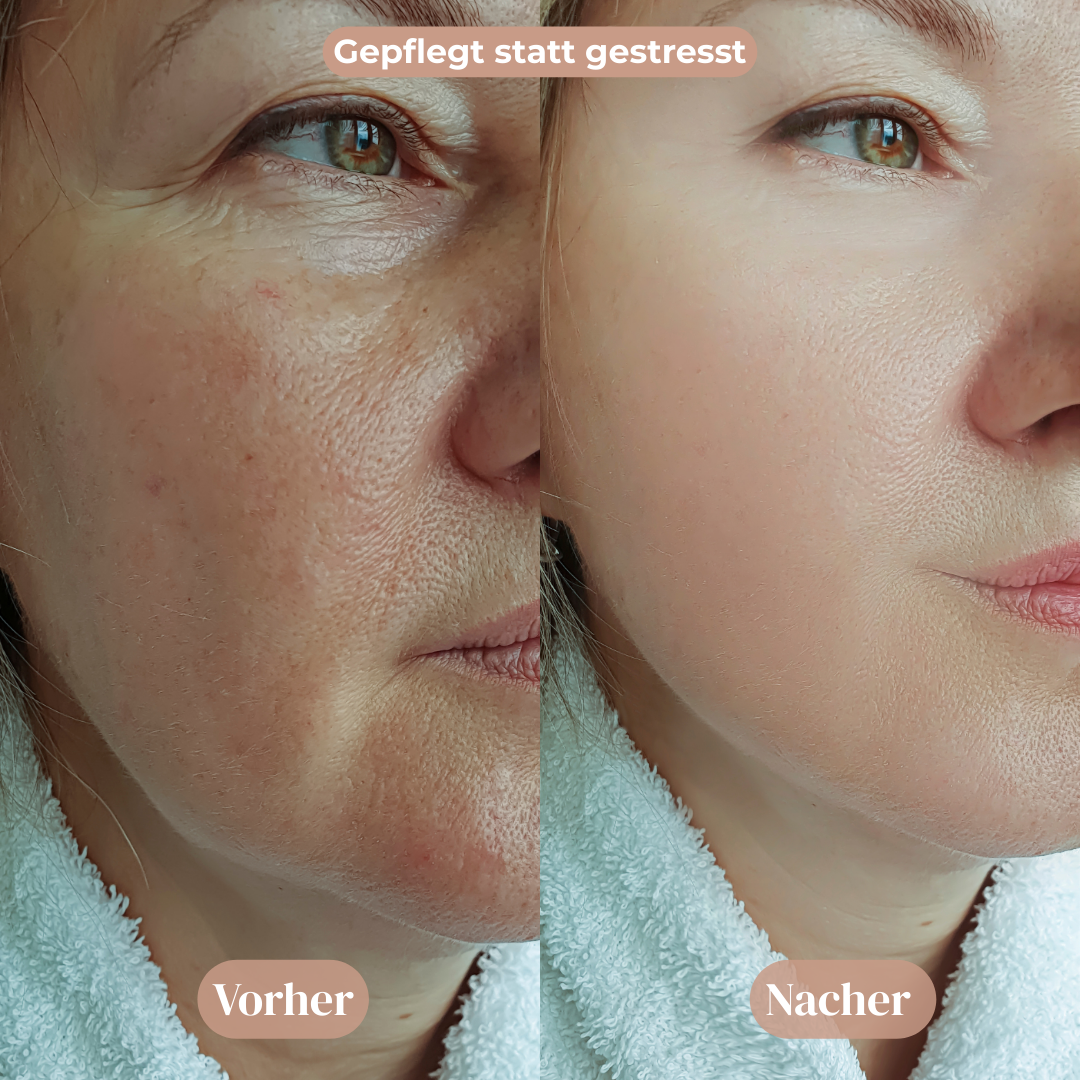 Vitamin Gesichtscreme™