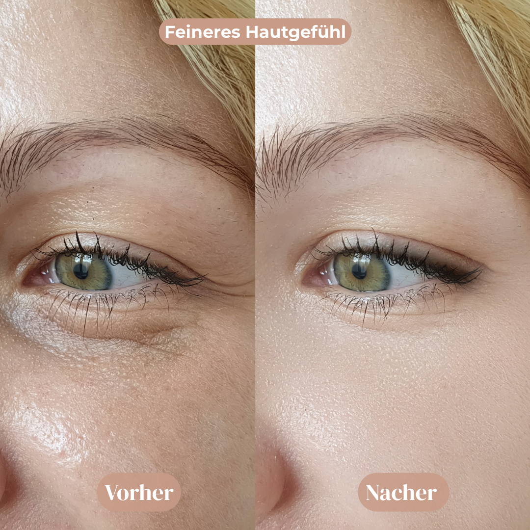 Vitamin Gesichtscreme™