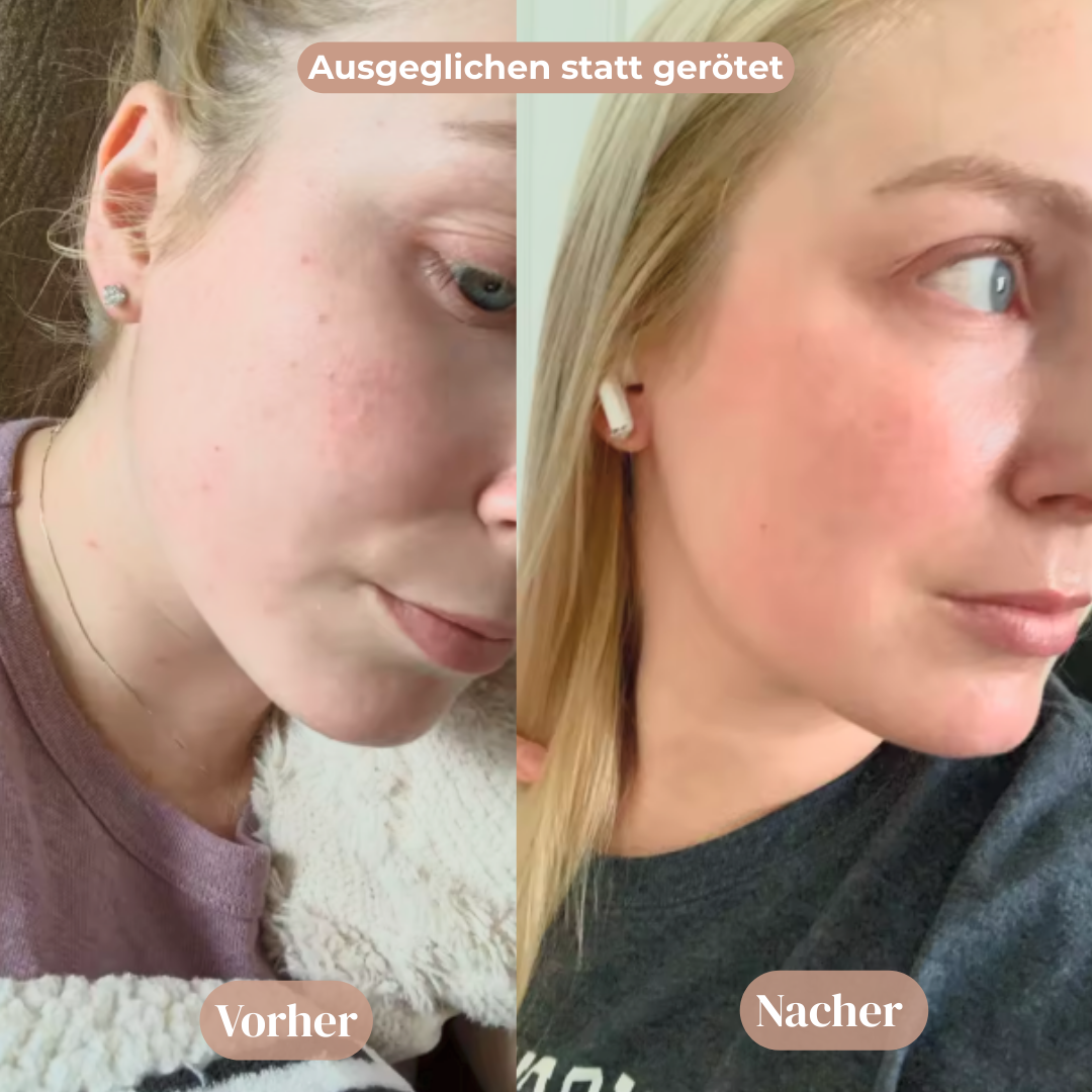 Vitamin Gesichtscreme™